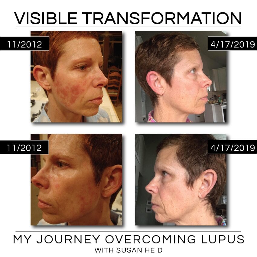 Before And After.png